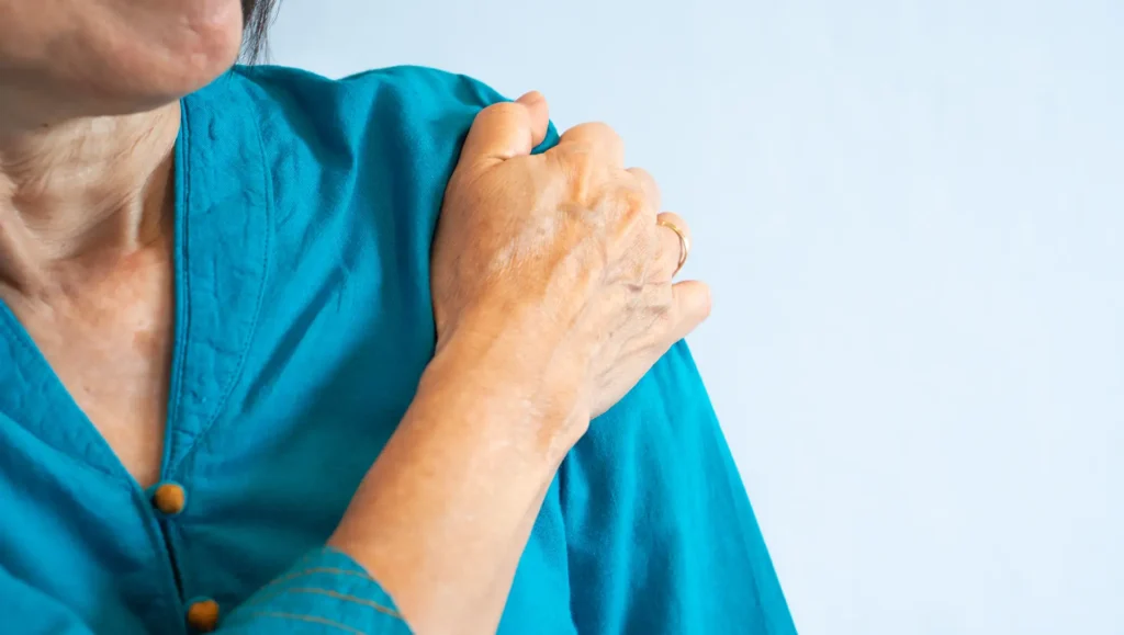 What Is a Frozen Shoulder and What Causes It