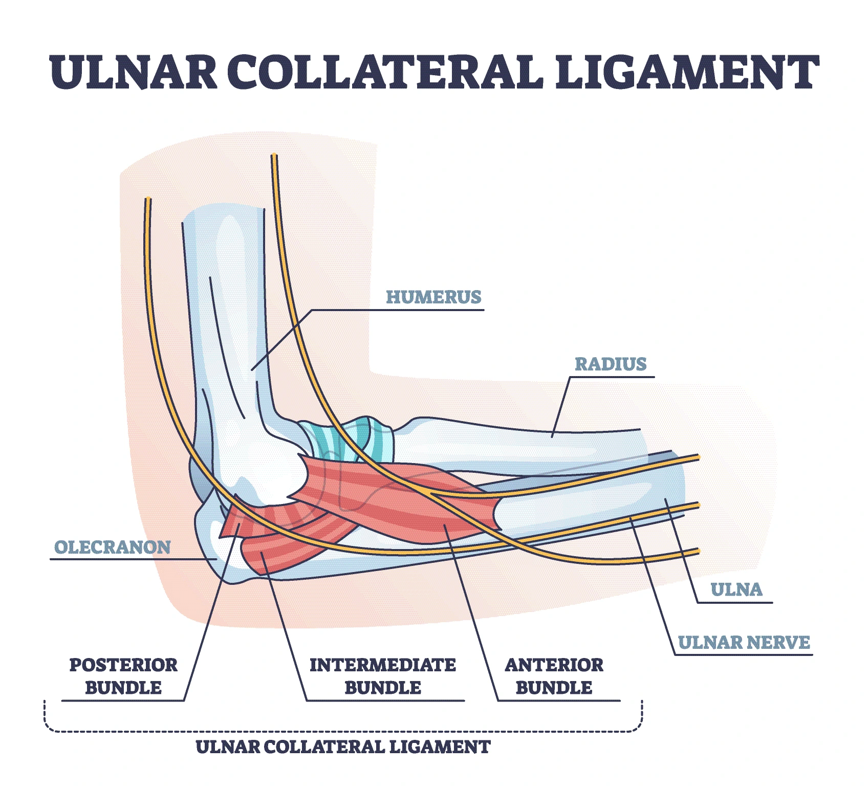 ucl_tear_diagram ulnar collateral ligament tear diagram.