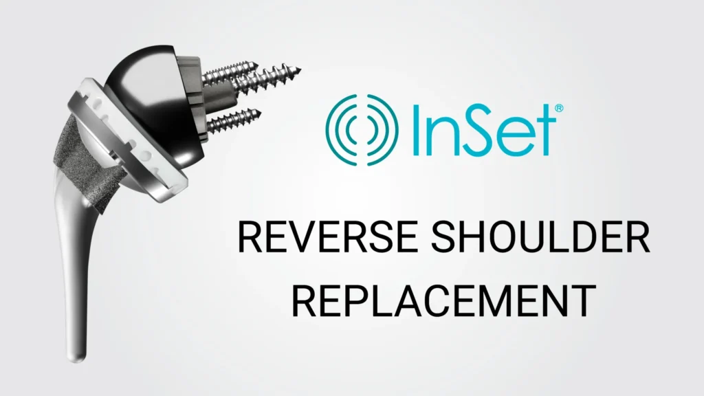 Implant Images RSA 2000 Reverse shoulder replacement implant